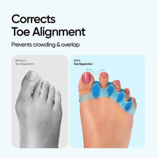 Toe Separators
