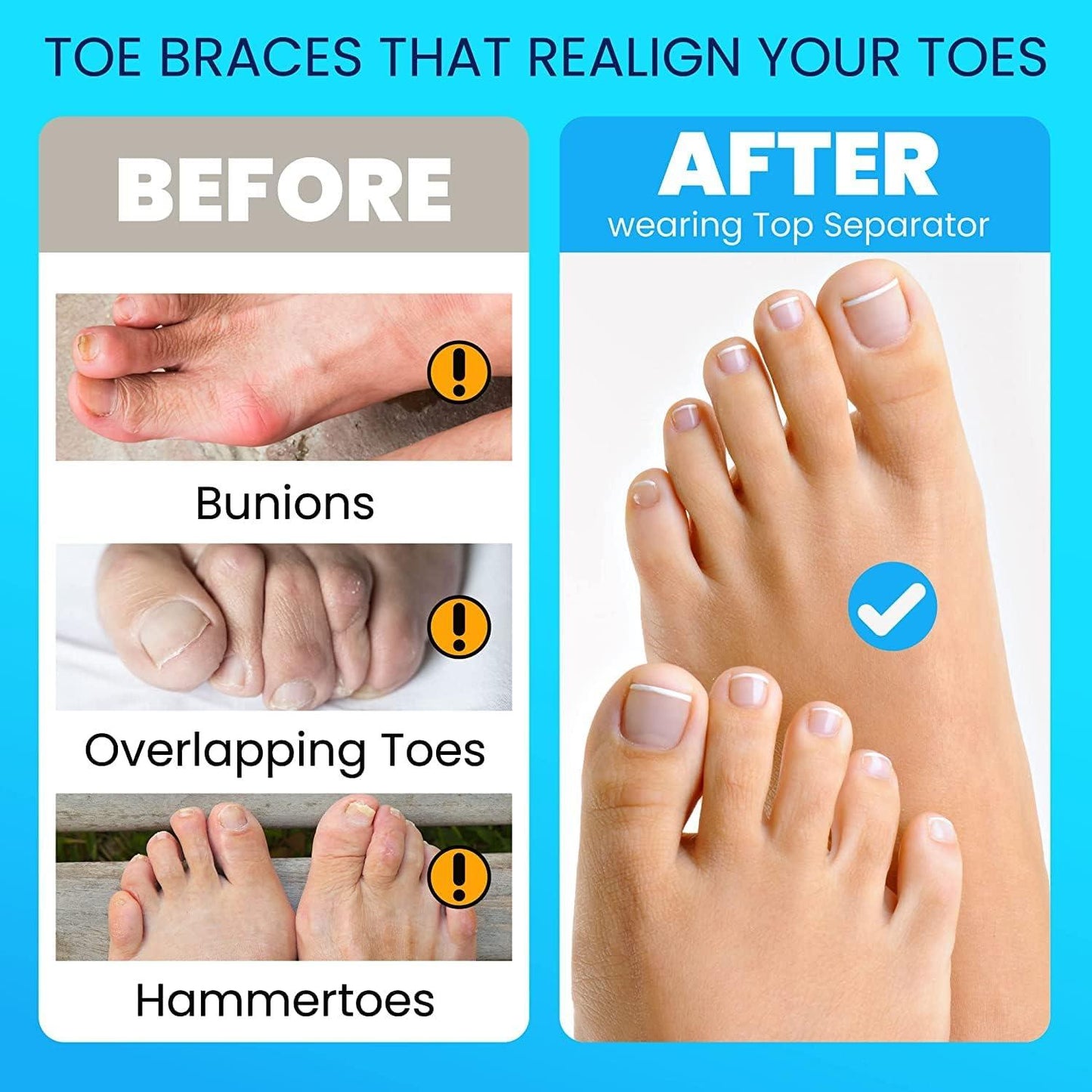 Toe Separators